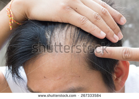 regrow hairline edges